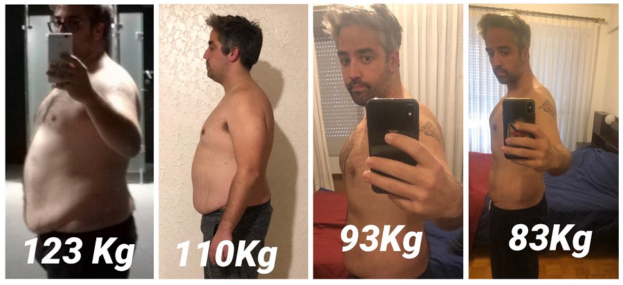 Antes e depois clinica tallon